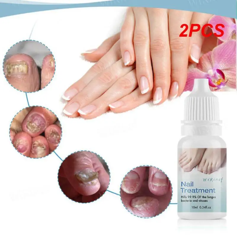 

2PCS Paronychia Cream Clinically Proven Revolutionary Toenail Fungus Remover For Women Nail Solution