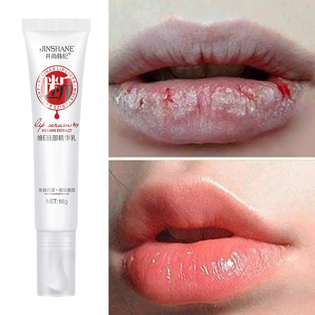 

Lips Pink Fresh Lightening Bleaching Cream Treatment Essence Smoke Nourishing Dark Whitening Moisturizer Lips Remove C6M9