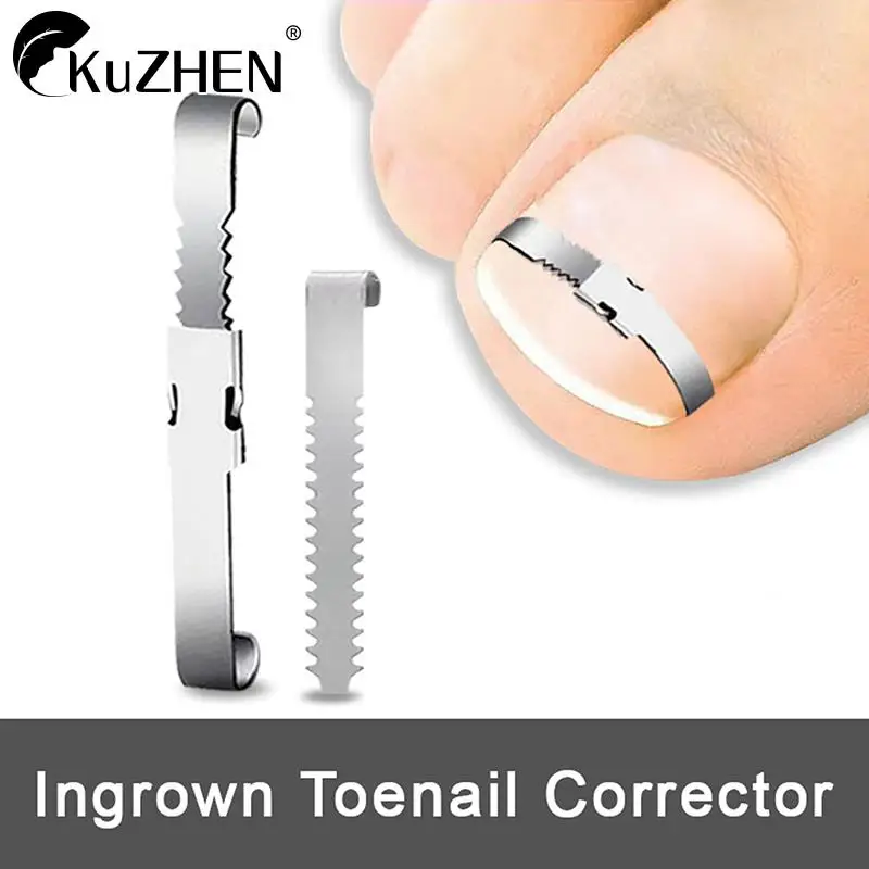 

Ingrown Toenail Corrector Tools Pedicure Recover Embed Toe Nail Treatment Professional Foot Care Correction Tool Care Foot