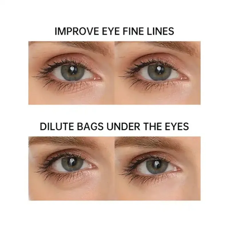 Multi-RF Radio Frequency Wrinkle & Anti Ageing Skin Tightening Device Dark Circles For Eye Face Neck Hands Toning Wrinkle Remova 5
