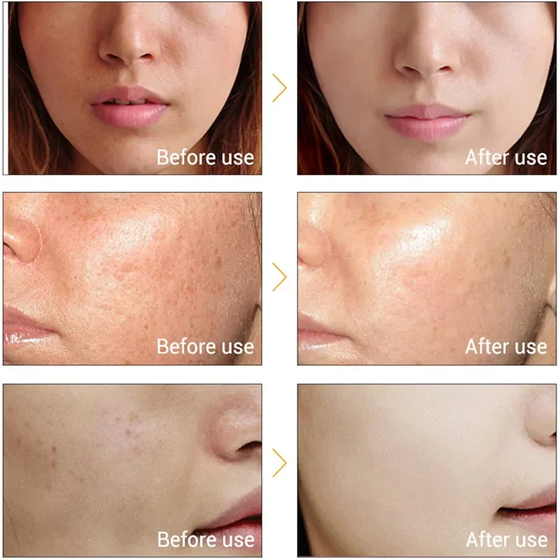 Facial Mesotherapy Electroporation RF&EMS Radio Frequency Photon Face Lifting Tighten Wrinkle Removal Skin Care Tools 2