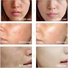 Facial Mesotherapy Electroporation RF&EMS Radio Frequency Photon Face Lifting Tighten Wrinkle Removal Skin Care Tools 2