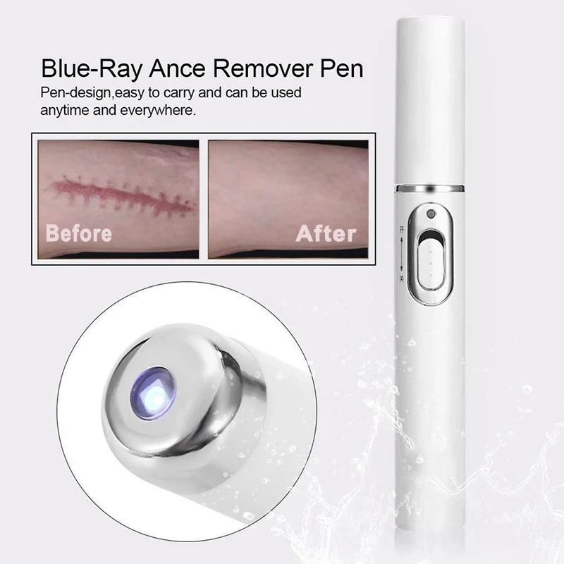 Laser Repair Skin Scars 1-7pcs Powerful Scar Removal Cream Fast Remove Deep Skin Scar Blue Light Therapy Pen Recovery Cream
