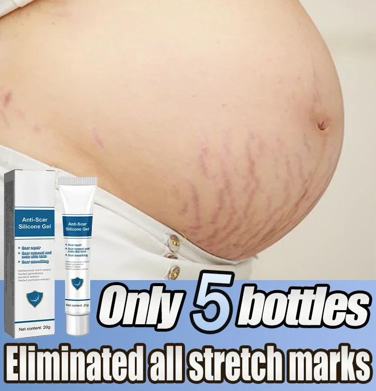 Eliminate Red White Old Stretch Marks Cream For Pregnancy Postpartum Skin Care Gel