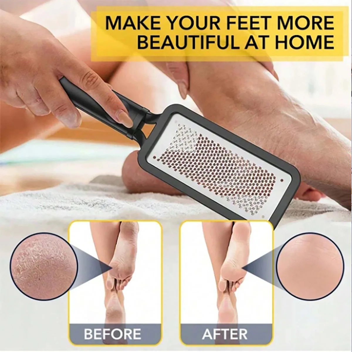 foot file Professional Double Side Heel Grater Hard Dead Skin Callus Remover Pedicure Foot Care Tools