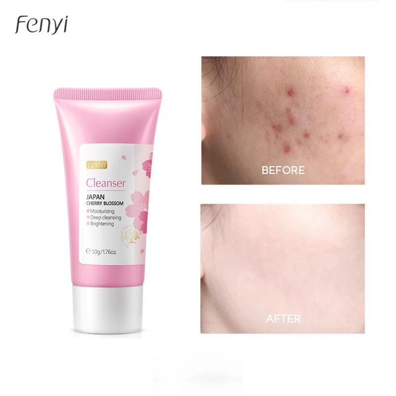 Fenyi Sakura Facial Cleanser Foam Face Wash Acne Moisturizing Shrink