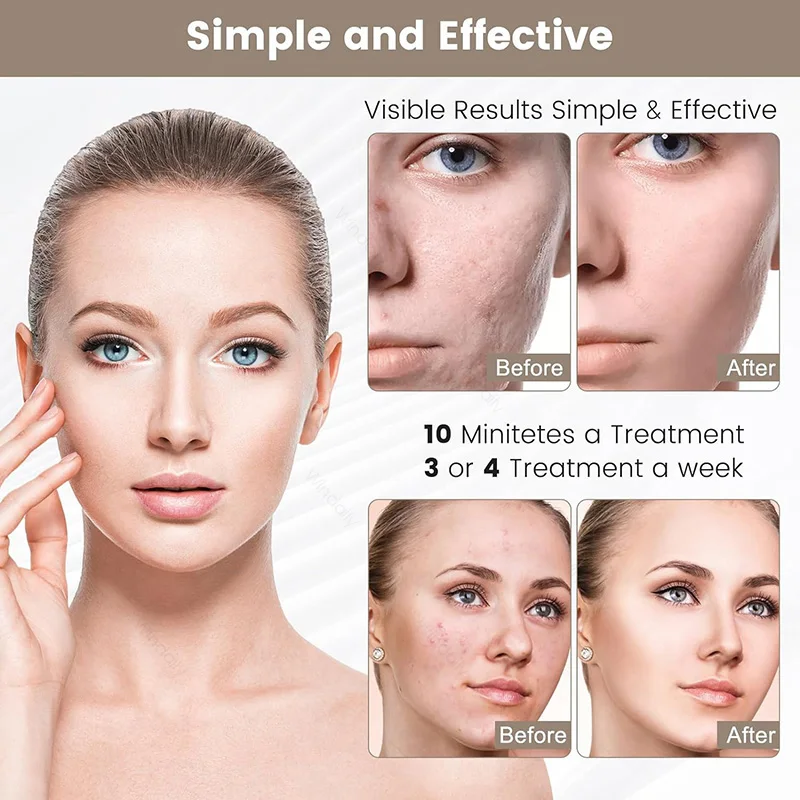 LED Light Therapy Facial Mask - Rechargeable Wireless Beauty Device for Anti-Aging & Skin Tightening