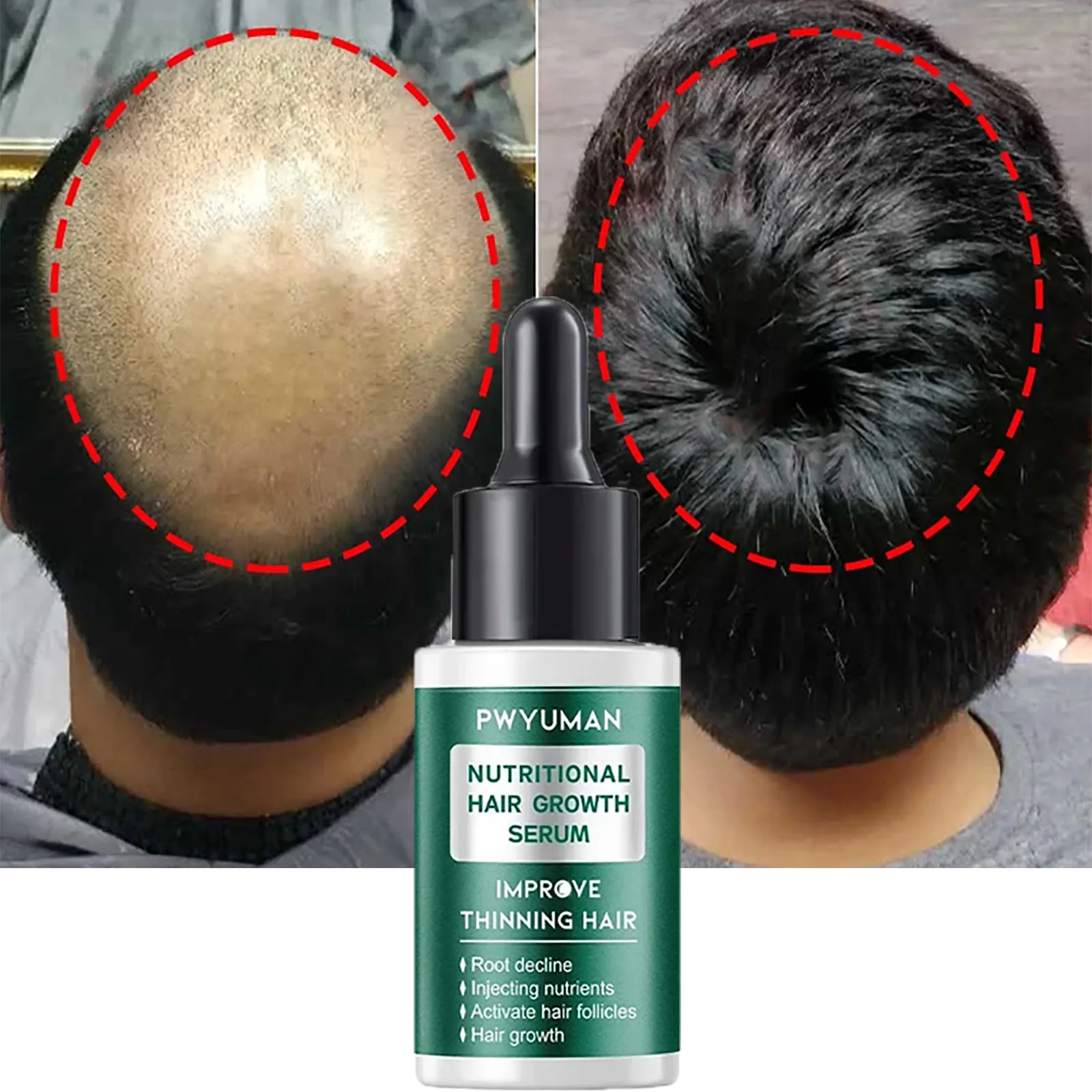 

Herbal Hair Growth Essential Oils Prevent Hair Loss Serum Product Fast Hair Regrowth Thicken Nourish Hair Root Oil 30ml PWYUMAN