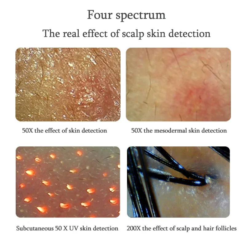 UV Skin Analyzer Machine Professional Scalp Detector Hair Follicles Oil Moisture Tester Facial Skin Hair Analyser Machine 11inch