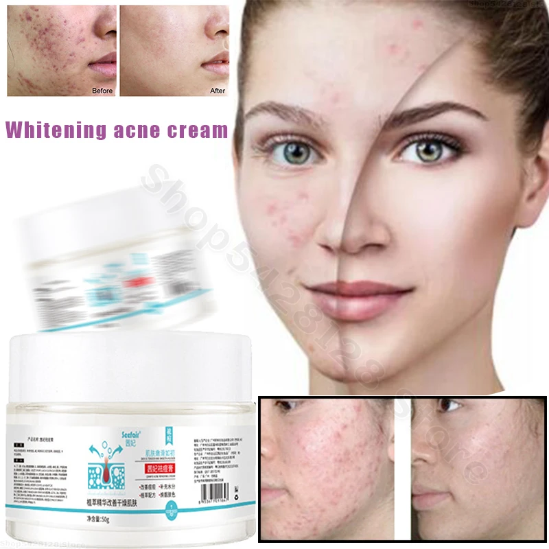 

Acne Removal Cream Freckle Cream Shrink Pores Whitening Moisturizing Oil Control Acne Cream Skin Care Acne Treatment Face Cream