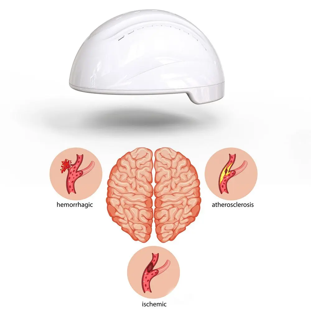 

PDT Treatment Infrared Light Therapy Device Brain Stimulation Photobiomodulation Helmet for Parkinson