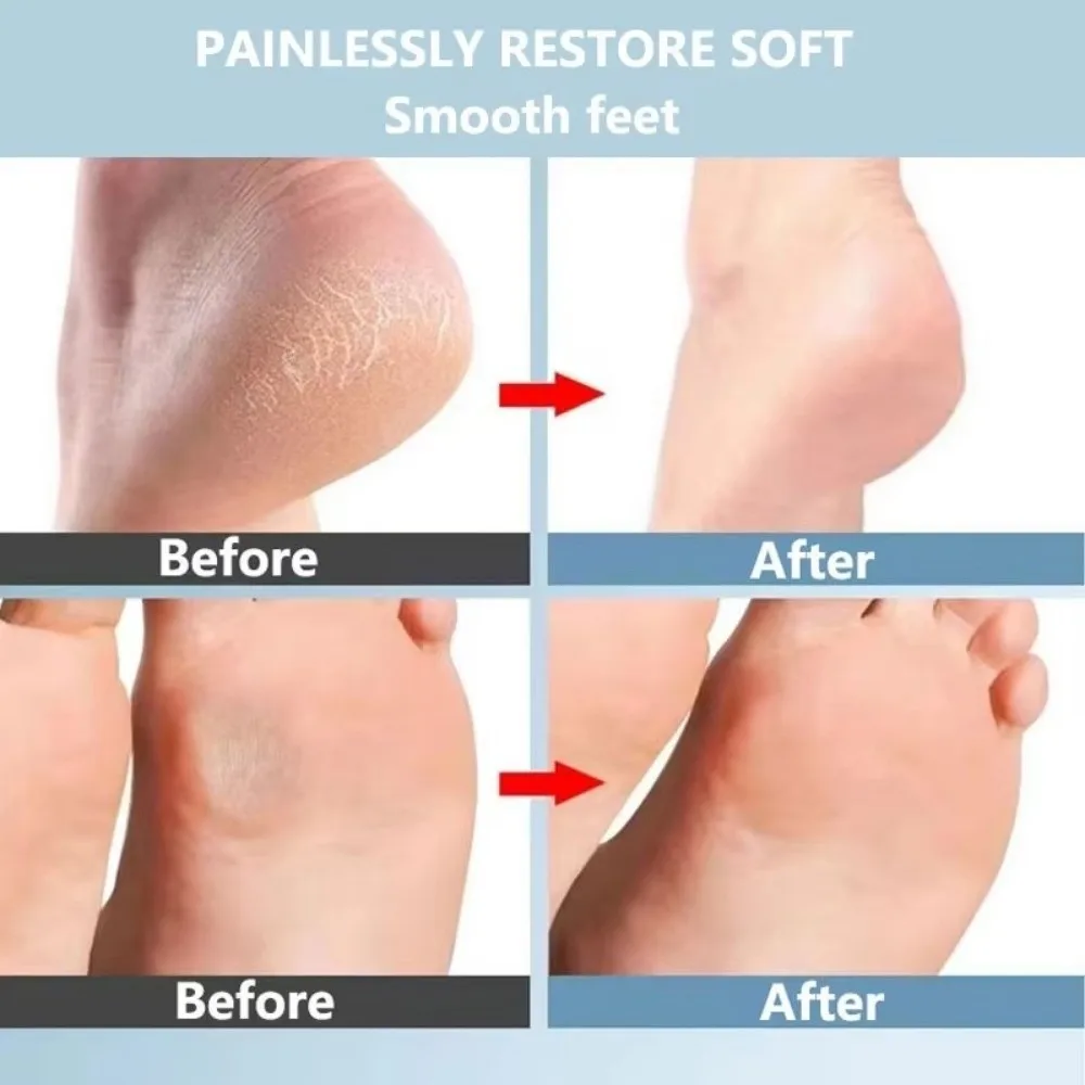 Nanoglass Hand Foot File Oval Callus Remover Foot Rubbing Board Scraping Heel Tool Dead Skin Remover Foot Scrubber