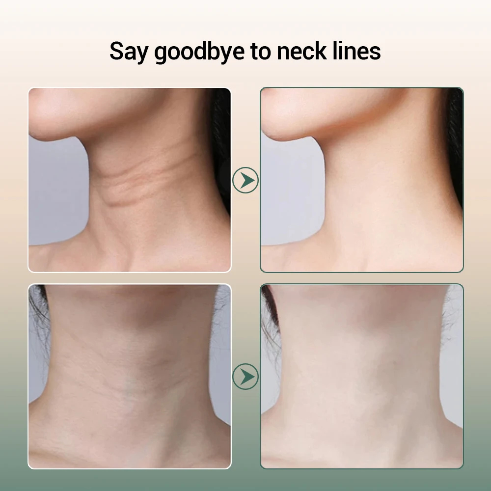 Neck Face Massager Electrotherapy Skin Care Tool EMS Microcurrent Face Neck Beauty Device Massager LED Photon Rejuvenation Skin Lifting Machine Anti Wrinkle Reduce Double Chin