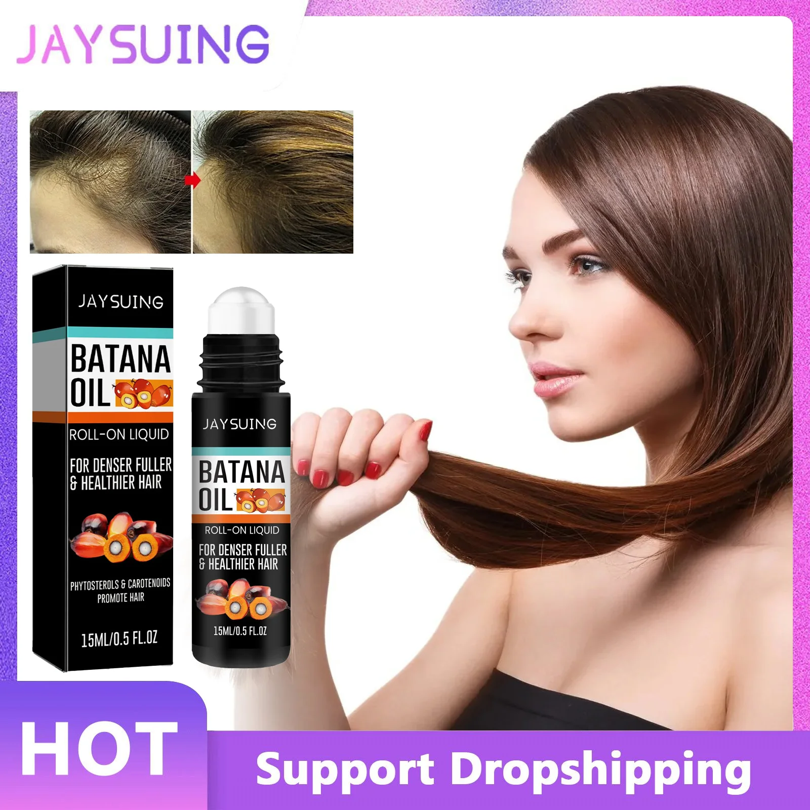 Anti Alopecia Essence Hair Loss Prevention Hair Regrowth Care Increase Hairline Repair Damaged Follicles Scalp Treatment Serum women ginger fast hair growth spray high hairline anti alopecia serum bald head men quickly increase head hair essential oil