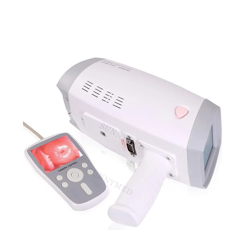 

SY-F005 Hospital 800,000 Pixels Vagina Price Digital Portable Video for Gynecology