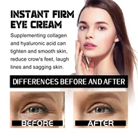 60ml Eelhoe Eye Tightening Cream Fading Wrinkle Eye Bags Dark Circles Firming Eye Skin Moisturizing Hydrating Anti-Wrinkle Cream 2