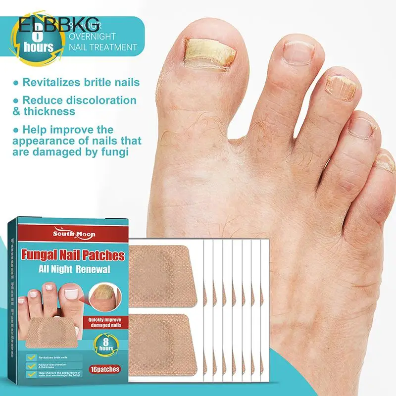 16Pcs/pack Nail Treatment Patch Anti Fungal Nail Correction Stickers