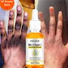 Dark Knuckles Fast Brighten Serum Elbows Hand Knuckle Brightening Serum Knee Black Skin Quickly Lighten Stains Remover Essence 1