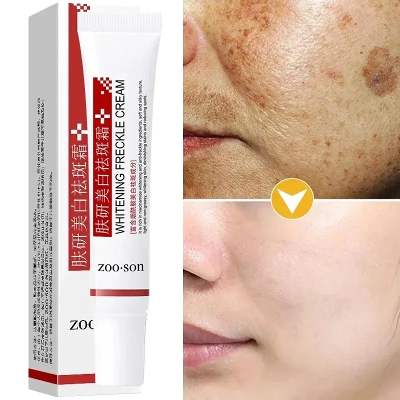 

Powerful Spot-removing Whiten Cream Brighten Skin Fast Eliminates Melanin Pigmentation Melasma Dark Spots Moisturize Beauty Gel
