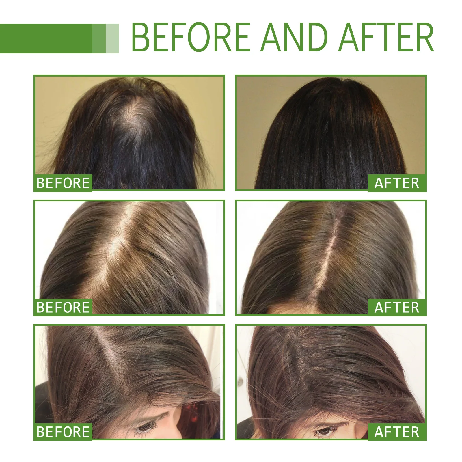 Discover more than 126 vitamin b12 hair growth latest ceg.edu.vn