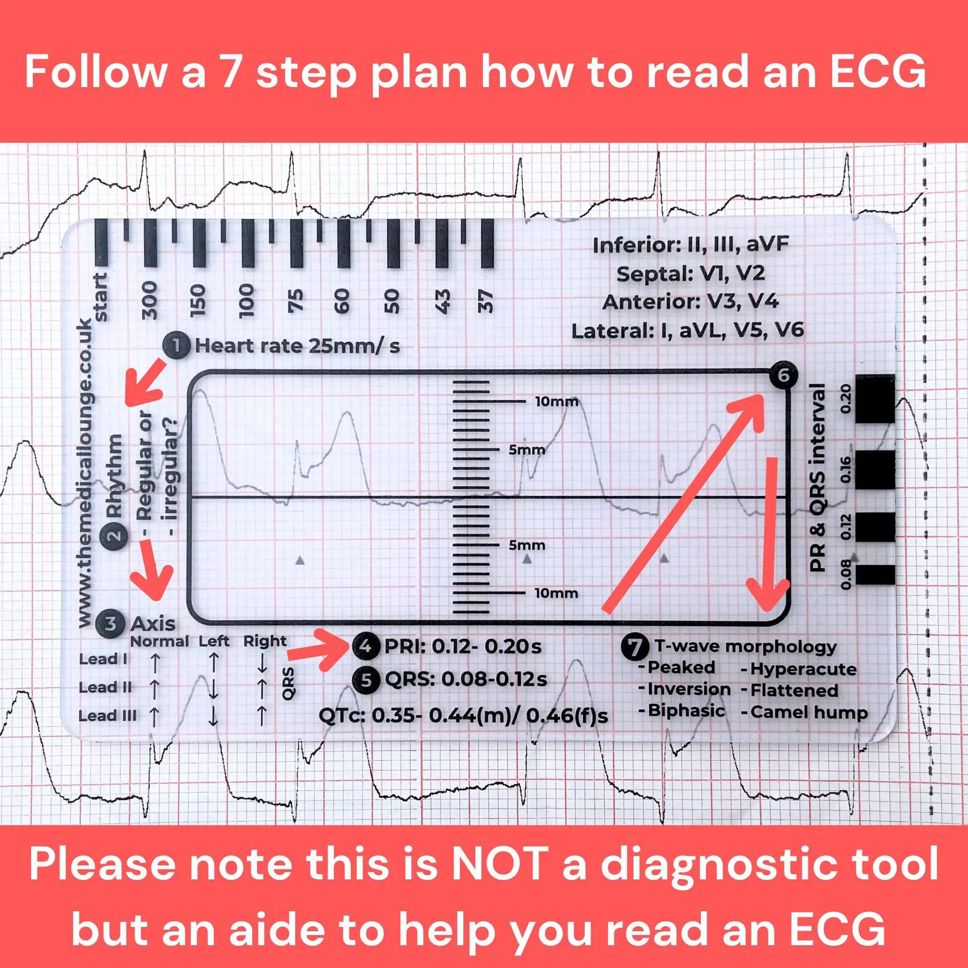 ECG 7단계 눈금자 ECG 해석 보조 눈금자
