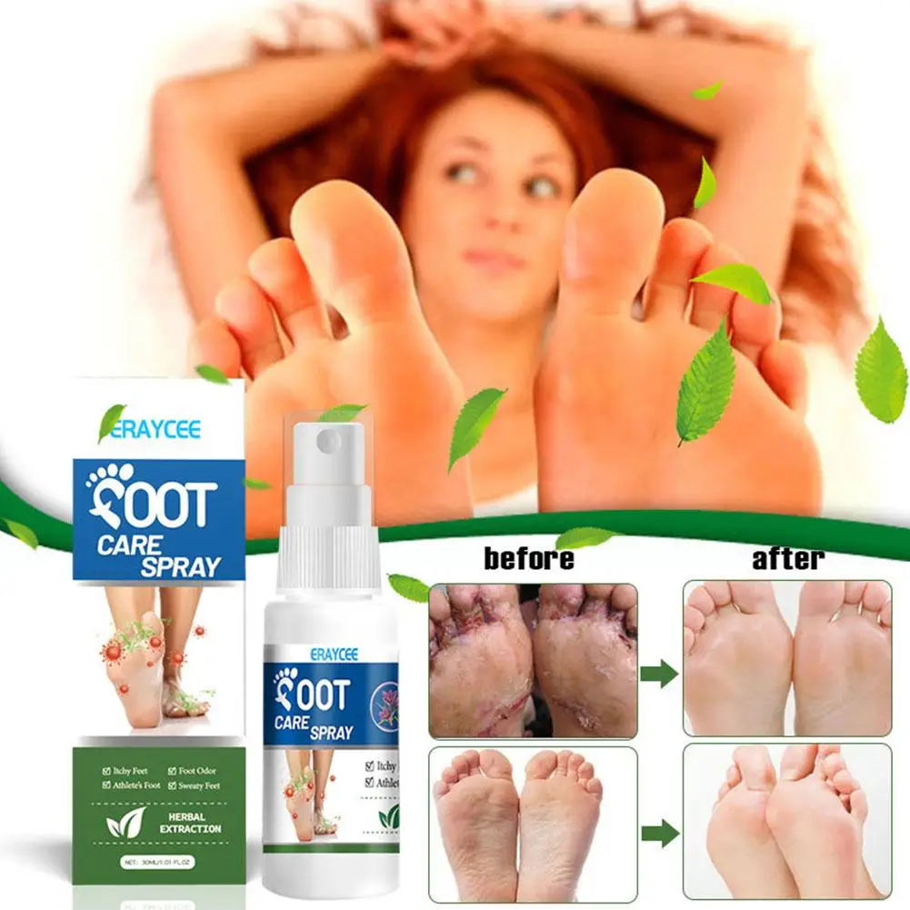 Description Picture 3 of item30ml Foot Deodorant Spray Relieve Itching Eliminate Spray Athlete's Foot Of Moisturize The Removal Foot Care Odor Anti-Swea B9M2