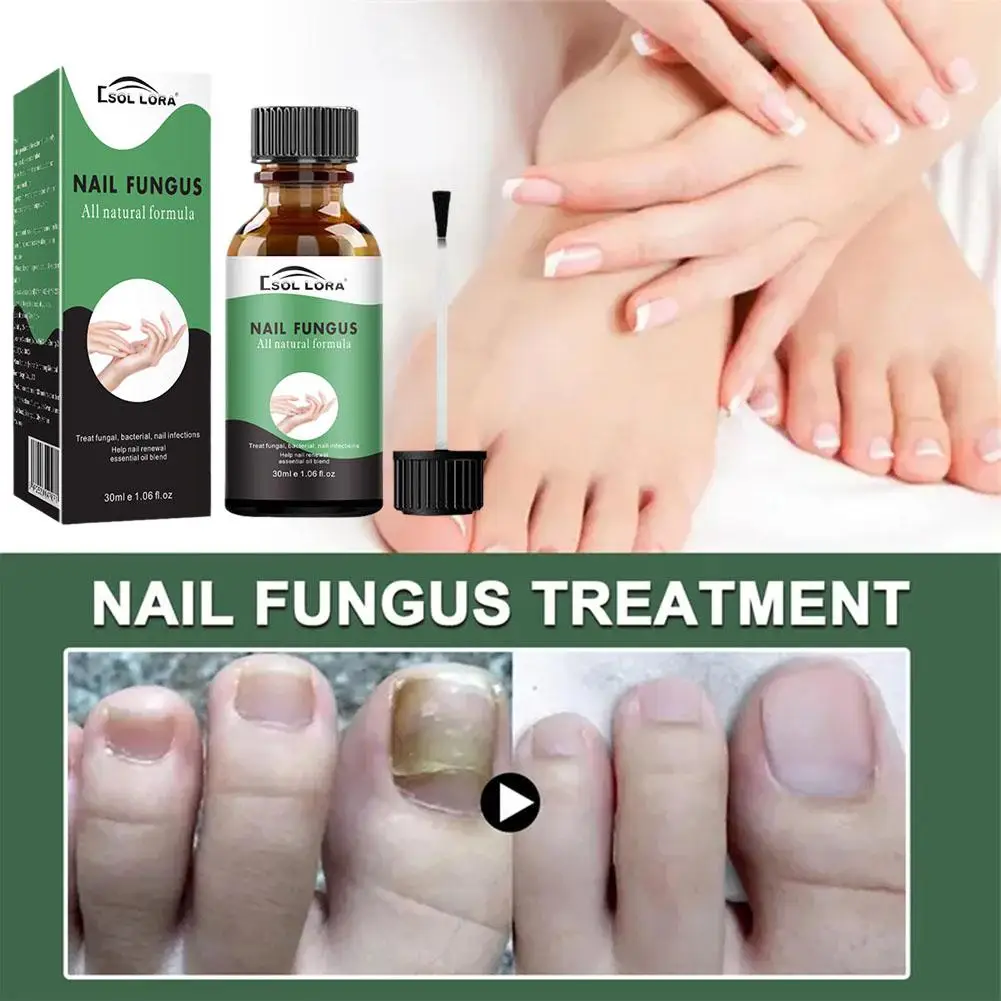 

Nail Repair Fluid Damaged Discolored Fingernail Strengthened Strong Nails Solution Essence Fast Anti-brittle Growing Nail S G8w8