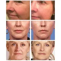 Crème pour le visage au rétinol déformable remodelé, anti-âge, raffermissante, lifting, estompe les ridules, hydratante, éclaircissante, soins de la peau, cosmétiques coréens 2