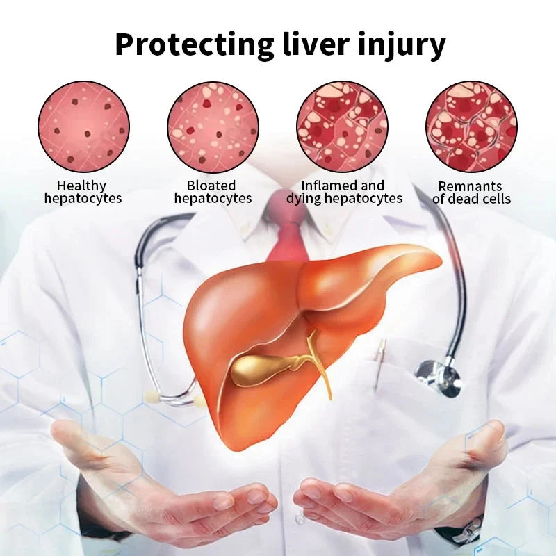 Liver Detox Cleanse Capsules Improve Liver Function Clean Toxin Slim Fat Prevent Fatty Support Gallbladder Health