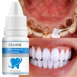 Teeth Whitening Essence Remove Plaque Stains Serum Fresh Breath Against Dental Caries Dental Teeth Bleaching Tools Oral Hygiene
