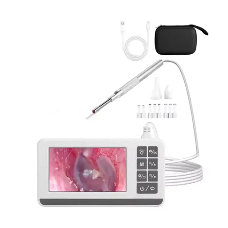 【인기】스마트 비주얼 귀 카메라 4.3인치 이경 귀지 제거 도구는 사진 및 비디오 녹화 기능을 지원합니다.