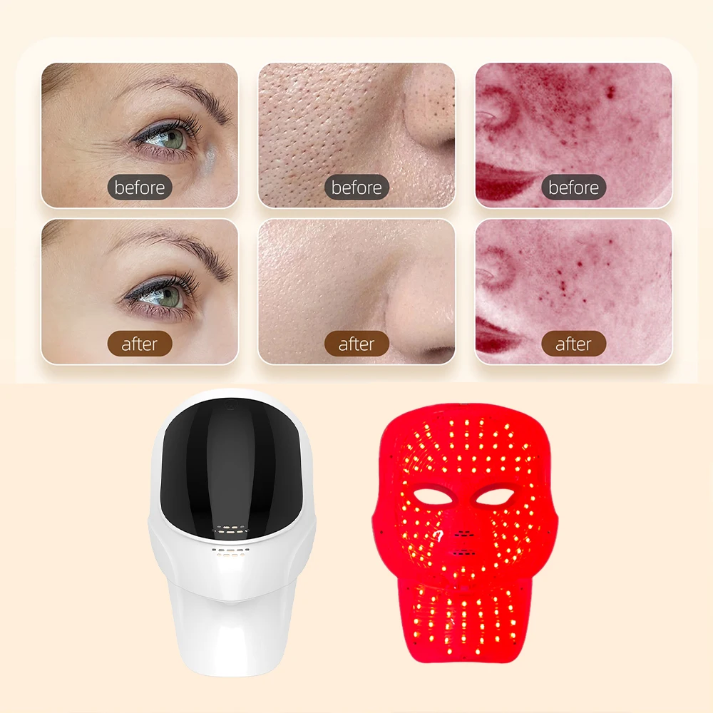 7 Colors Face Mask and Neck LED Therapy Anti Aging Wrinkle Acne Pore Oil Control Skin Tighten Whitening Anti Acne Face Lifting