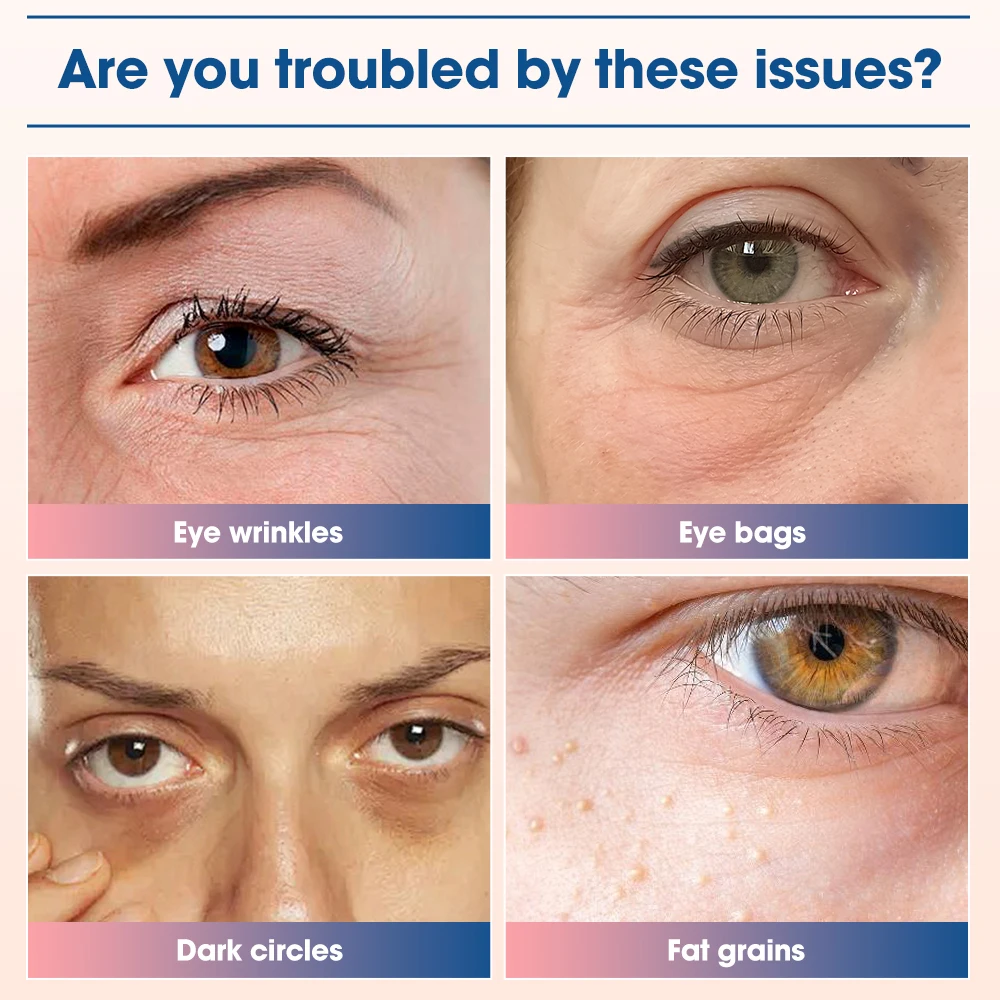 EMS Pulse Microcurrent Eye Care Device Eye Massager To Relieve Fatigue Massage Reduce Dark Circles Eye Swelling Anti-Wrinkle