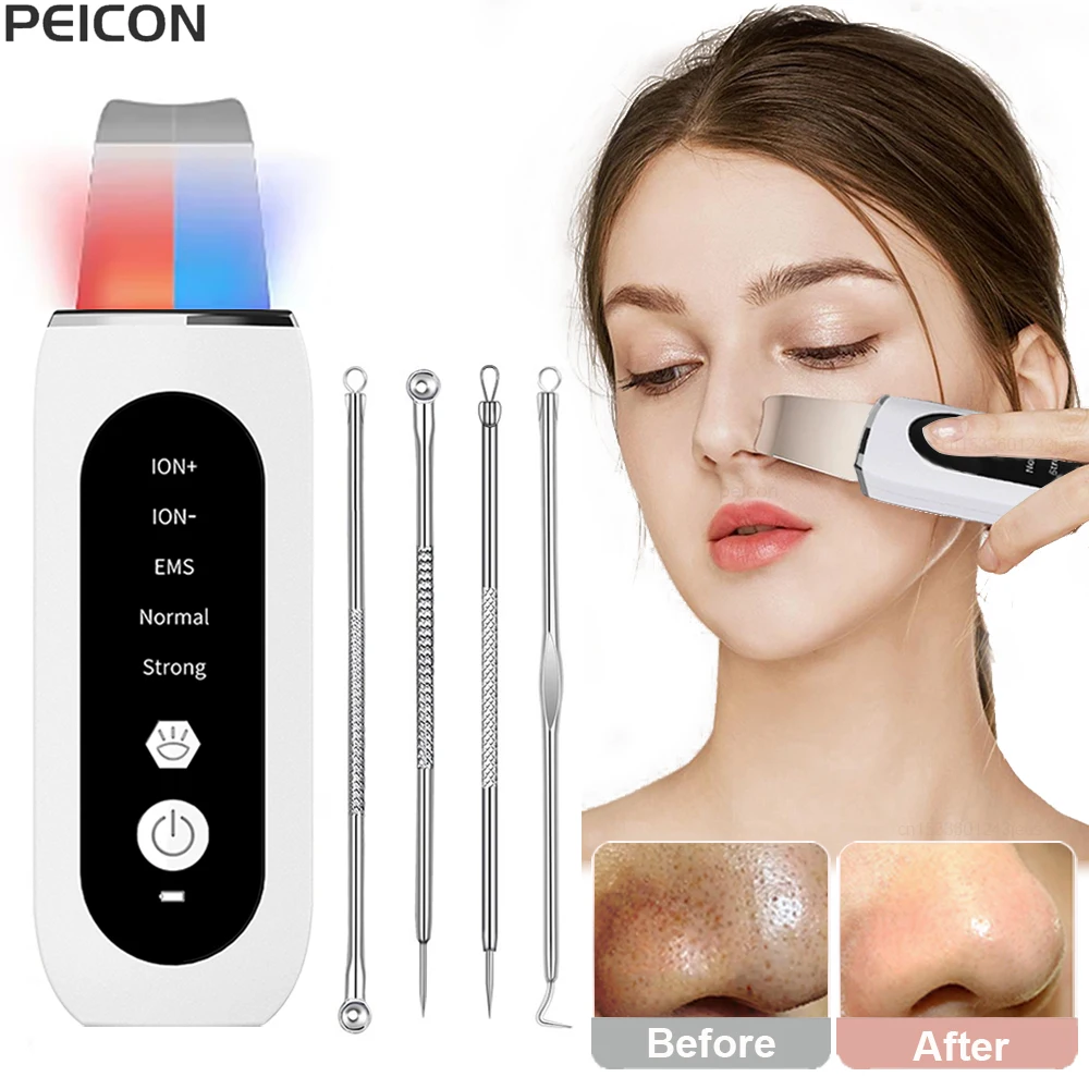 Ultrasonic Skin Scrubber Blackhead Remover Deep Facial Cleaning Ance Pore Spatula Facial Peeling Face Scrubber Cleanser