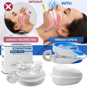 Paradenti anti-russamento Migliora il sonno Paradenti per russare regolabile Anti-apnea Denti Bruxismo Smettere di russare Dispositivo Bocchino