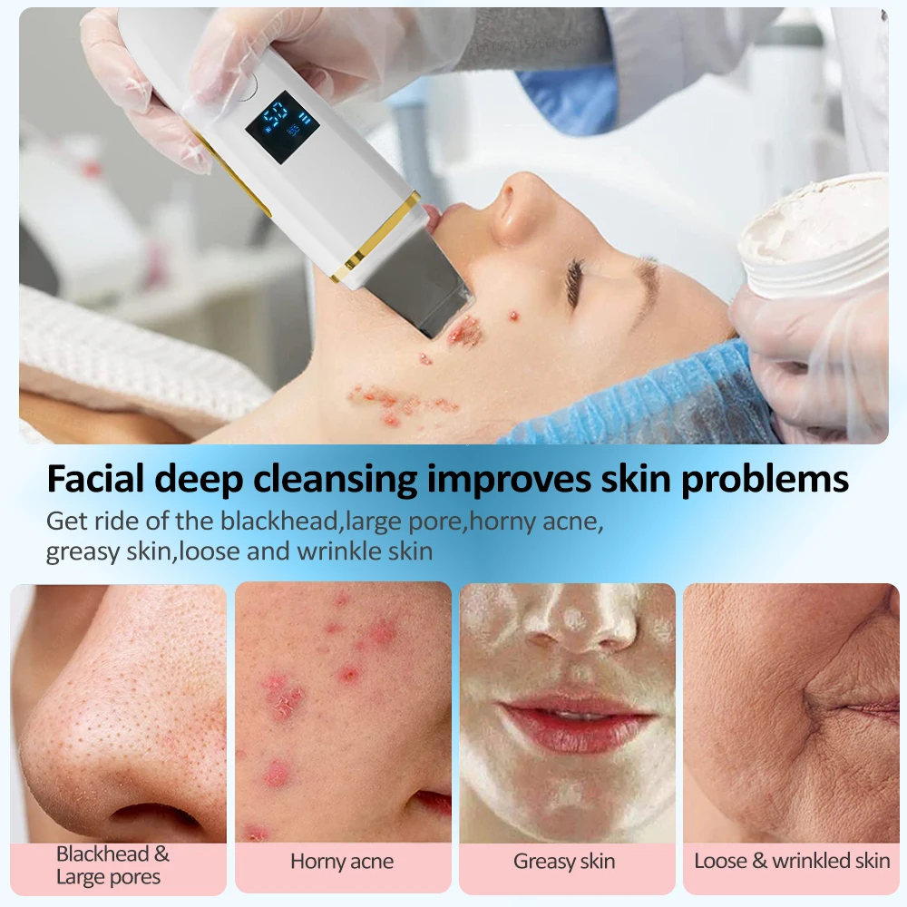 Face Skin Scrubber Ultrasonic Face Shovel Cleaning Dead Skin Peeling Acne Pore Spatula Deep Cleaner EMS Blackhead Remover Device