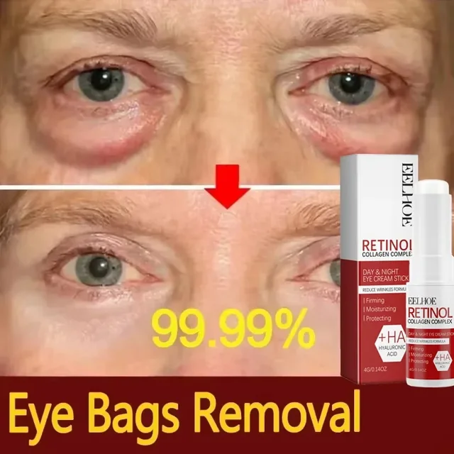 Retinol Eye Cream Collagen Multibalm Stick Reduce Wrinkles Eye Bag Hyaluronic Acid Anti Dark Circle Puffiness Eye Care Products 3