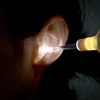 LED Light Earpick Baby Ear Cleaner Endoscope Penlight Spoon Cleaning Ear Curette Light Spoon with Ear Wax Removal Tools 2
