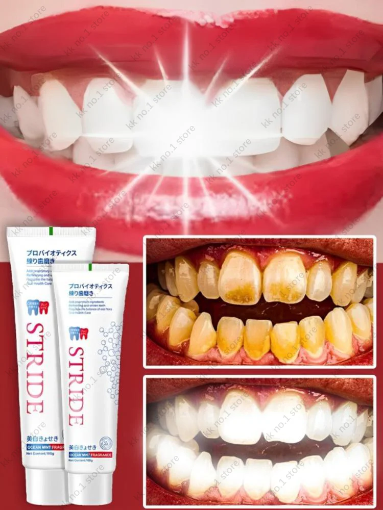 Whiten Teeth Remove Yellow Teeth Tooth Stone Bad Breath Oral Cleaning Toothpaste natural plant extract to repair tooth decay whiten teeth remove tooth decay cleaning stain remove cigarette stains reduce yellow