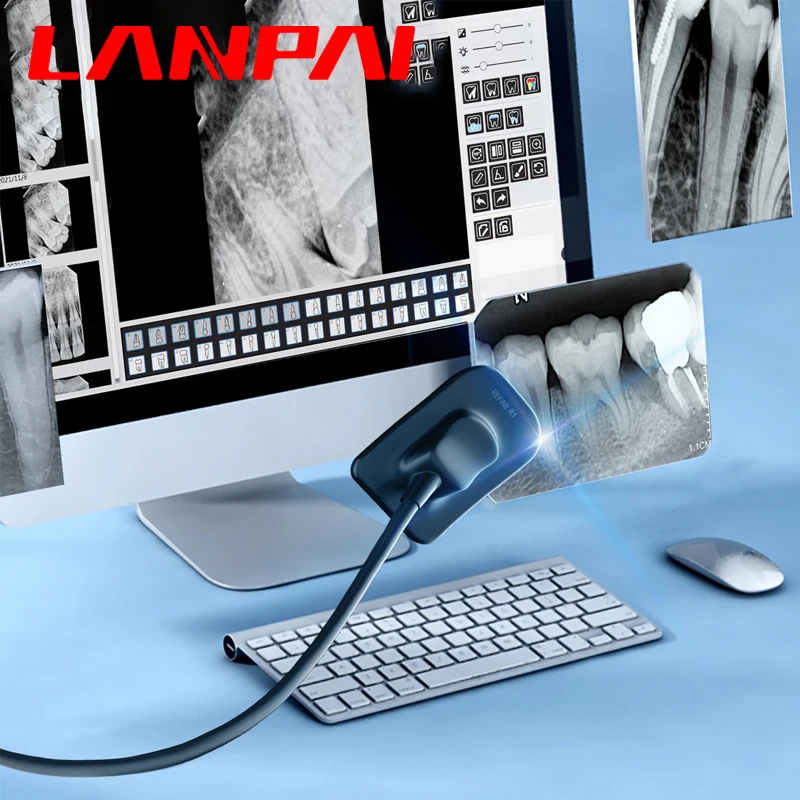 Lanpai 치과 엑스레이 센서, 라디오비시그래프, RVG 구강 내 휴대용 Rx 디지털 시스템, 치과용 13 개 언어