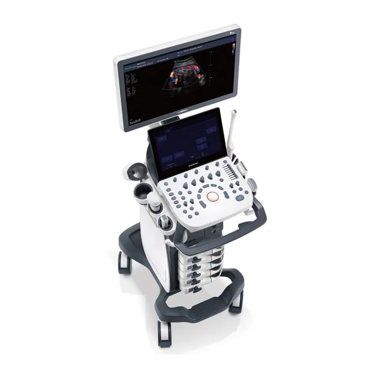 Prodotti Soggetti A Negozionationsonoscape P15 Ultrasound Mobile 3D 4D 5D Ecocardiografia Ecografo Ultrasuoni Color Doppler