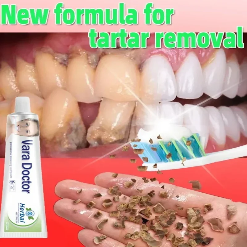 Whitening Teeth Remover Dental Calculus Mouth Odor Removal Bad Breath Preventing Periodontitis Remove Oral Stains Tooth Care