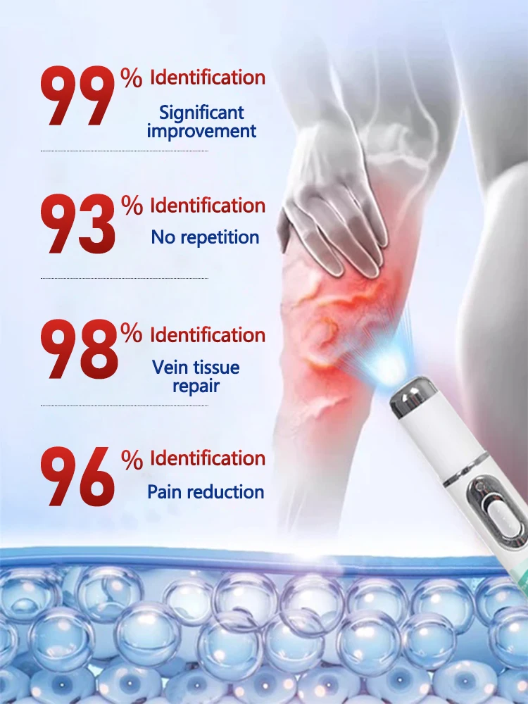 This kind of laser therapy for varicose veins&mdash;It can help ease that leg discomfort