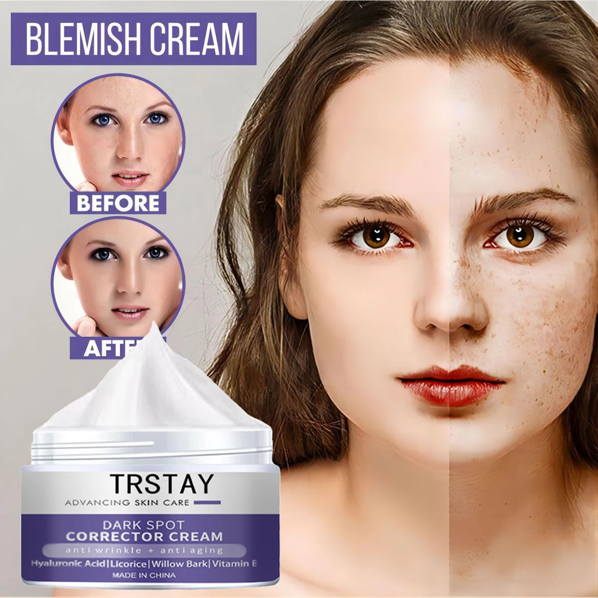 Face Cream Freckle Anti-Wrinkle Moisturizing Shrink Pores Whitening Brightening Firming Nourishing Skin Care
