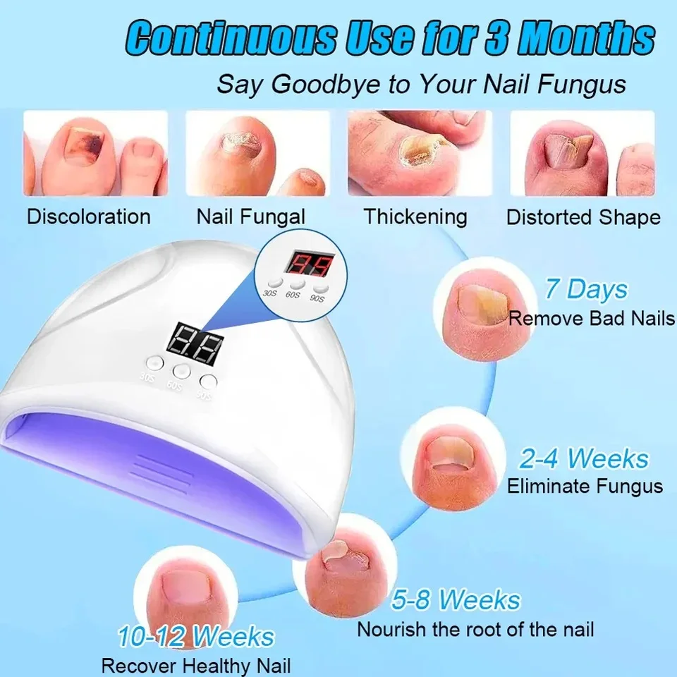 Nail Fungus Remover Laser Device for Onychomycosis 910nm 407nm