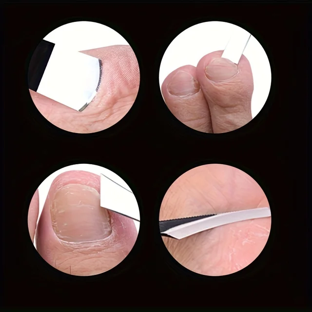 Set di coltelli per pedicure da 4 pezzi, kit per la rimozione dell'unghia del piede incarnita, strumenti per rasoio per calli per pedicure, raschietto per piedi professionale per la cura del piede 3