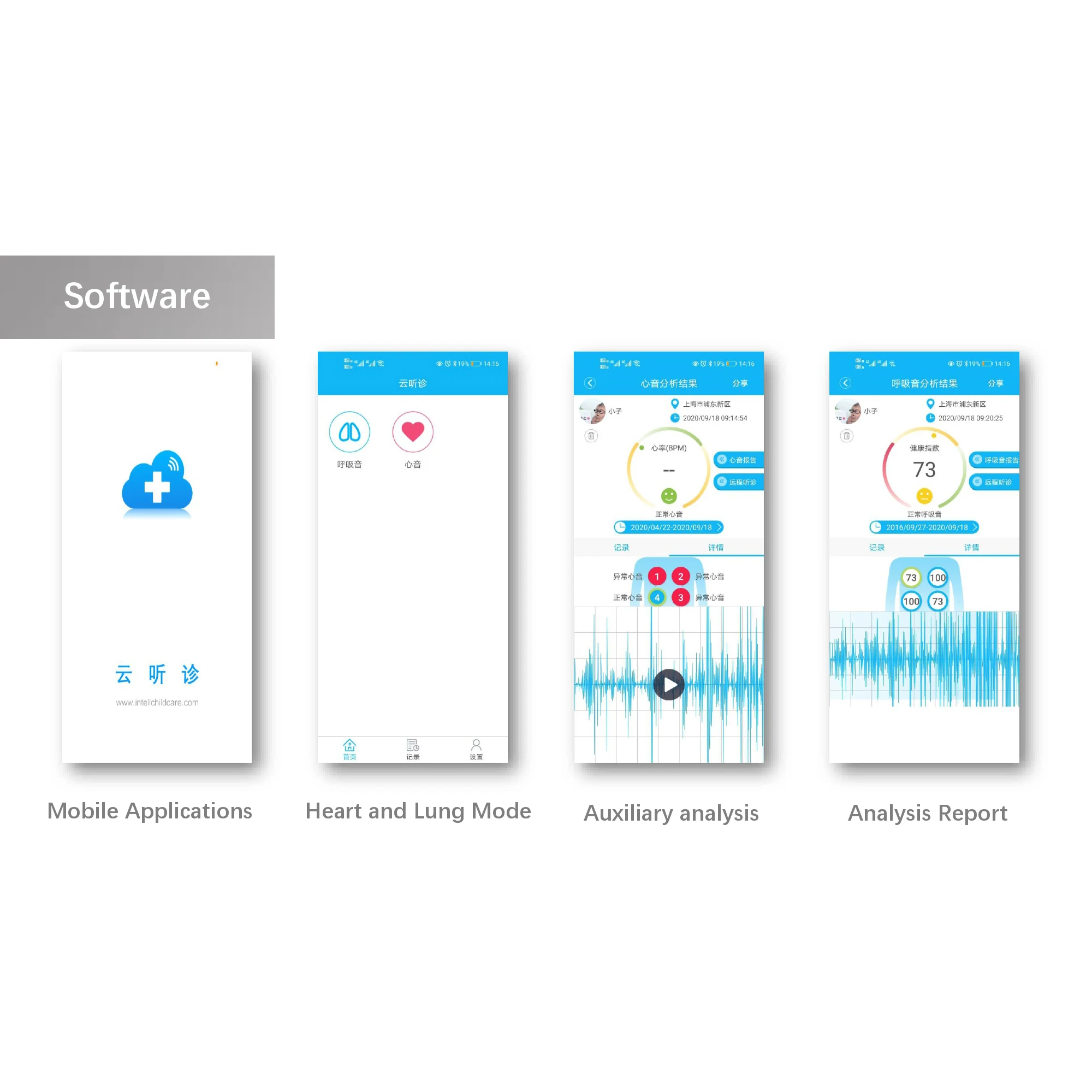 Medical Bluetooth Stethoscope Cardiopulmonary Recording Stethoscope 60 Times Amplify Sound Doctors Nurse Health Care