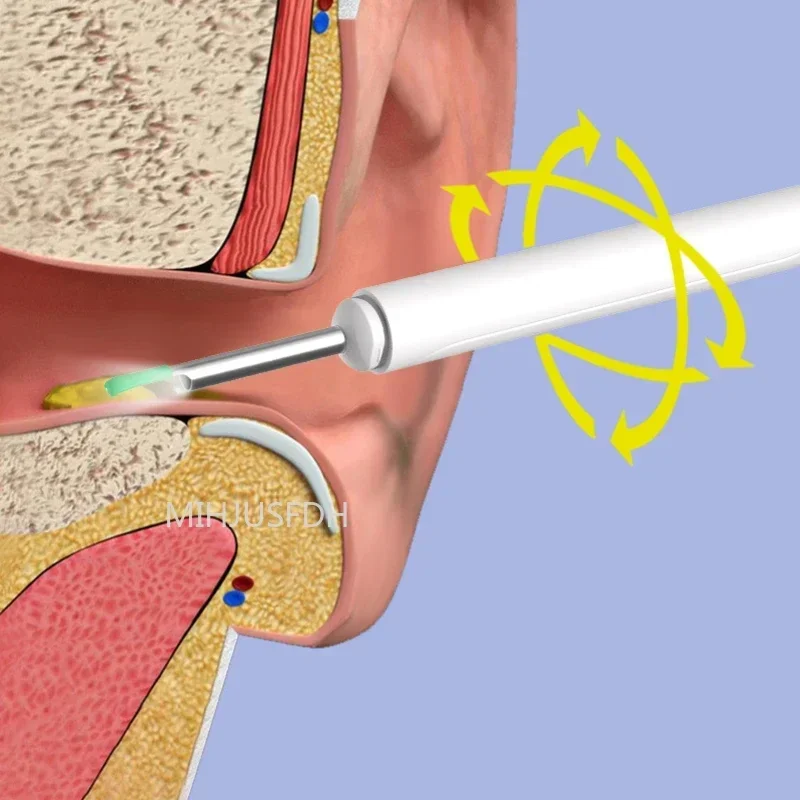 Visual Ear Cleaner with Camera LED Lights Lens Ear Wax Removal Tool Take Video HD Ear Wax Removal Tool Dropshipping 3