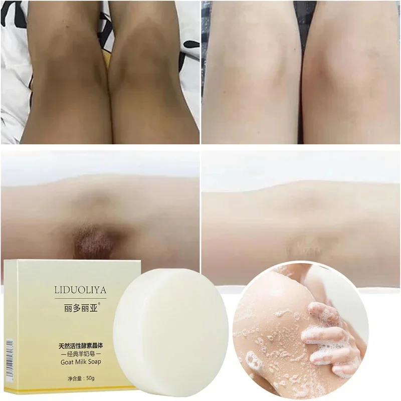 Body Whitening Soap Chicken Skin Removal Underarm Knees Bleaching Soap Dark Spot Removal Dead Skin Moisturizing Body Treatment