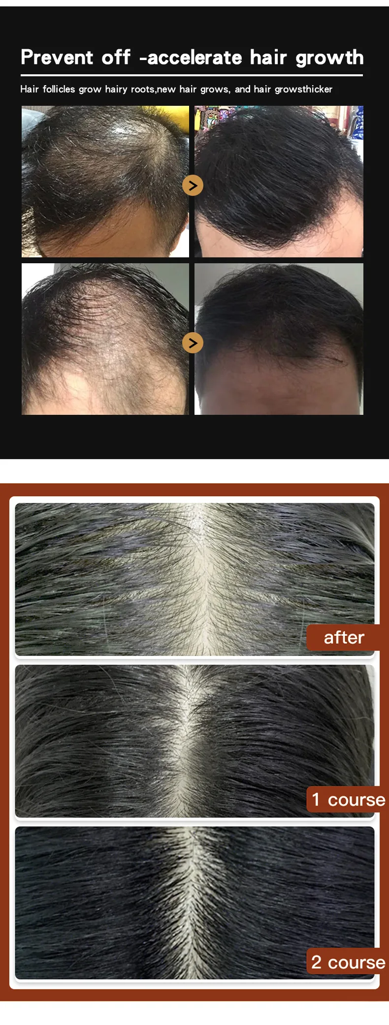 Crescimento do Cabelo do Gengibre Crescimento do Cabelo do Óleo Condicionador de Crescimento do Cabelo Soro de Crescimento do Cabelo Essencial Eficaz Rejeitar Calvície 30ml 6 Crescimento do cabelo do gengibre crescimento do